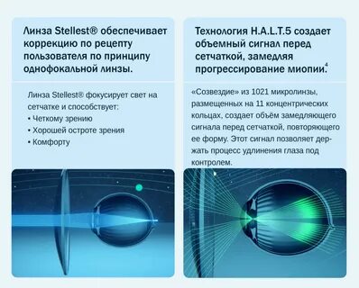 Катаракта линзы отзывы