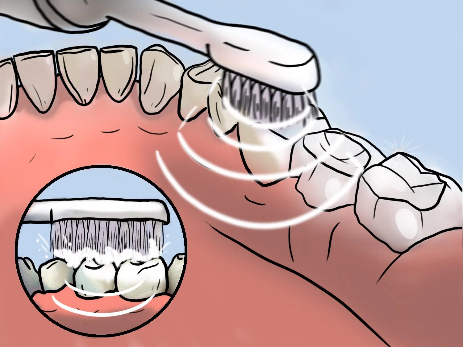 Чистка щеткой передних зубов. Как чистить десна