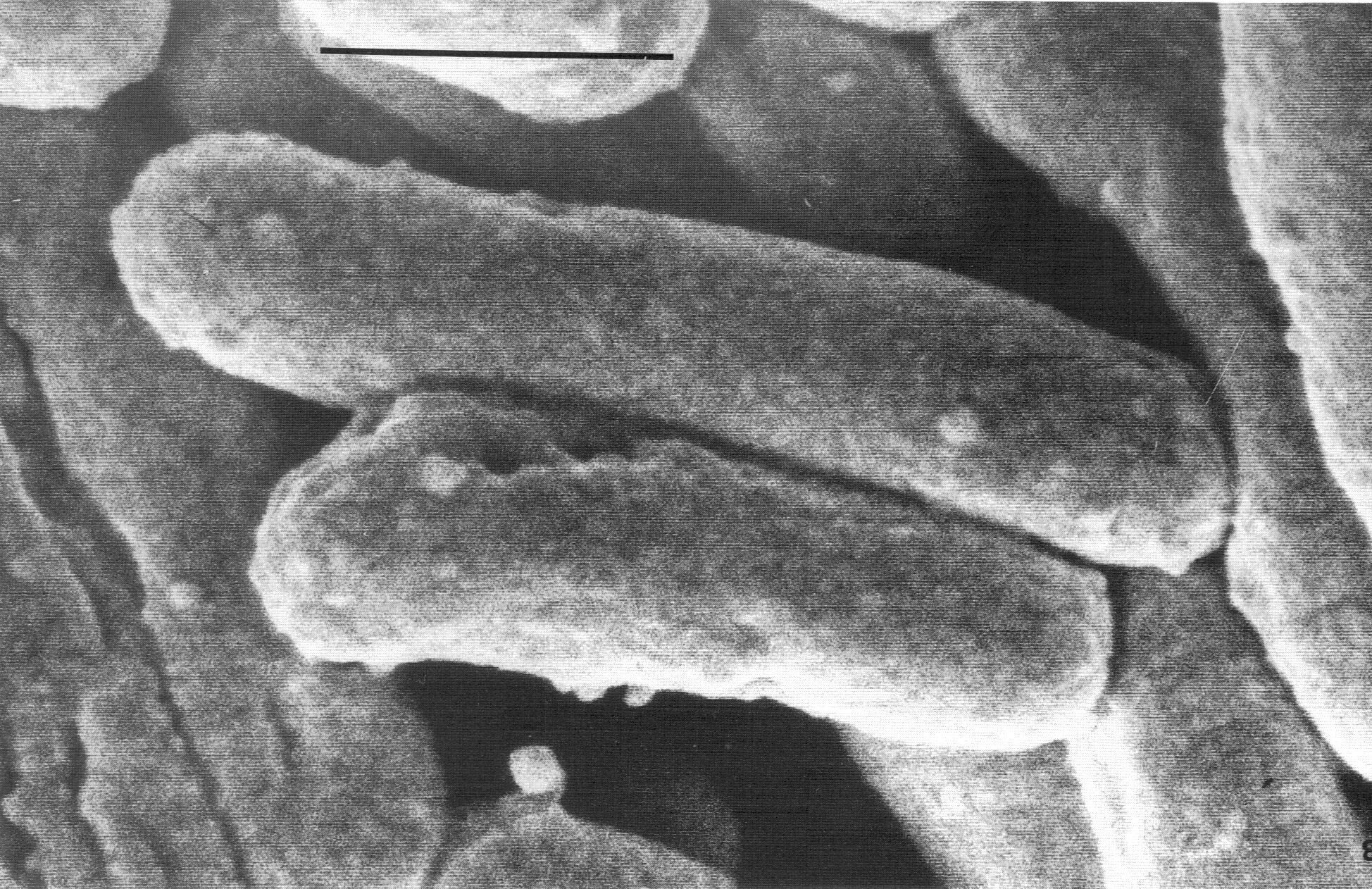 Заболевание туберкулез вызывают бактерии. Палочка Коха Mycobacterium tuberculosis. Микобактерия Бовис.