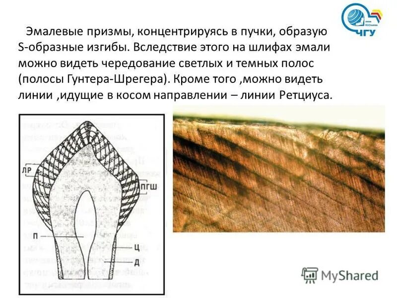 Гистология эмали зуба. Поперечная исчерченность эмалевой призмы. Эмаль пульпа зуба гистология. Строение эмалевой призмы гистология. Эмаль зубов строение гистология.