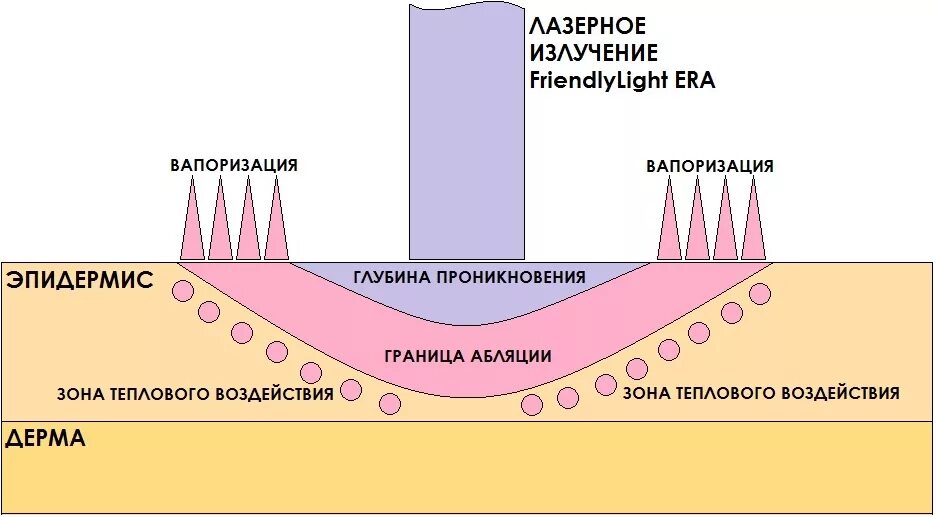 Проникнуть в глубь. Механизм действия лазера на ткани. Механизм действия лазерного излучения на биологические ткани. Воздействие лазерного излучения на кожу. Механизмы воздействия лазерного излучения.