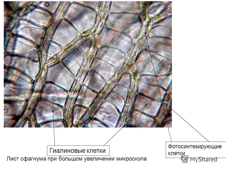 Водоносные клетки в листьях имеет. Гиалиновые клетки сфагнума. Гиалиновые клетки сфагнового мха. Клетки листа сфагнума под микроскопом. Сфагнум клетки листа сфагнума.