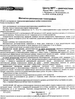 Сагиттальный размер позвоночного канала