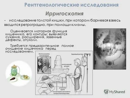 Подготовка к исследованию кишечника