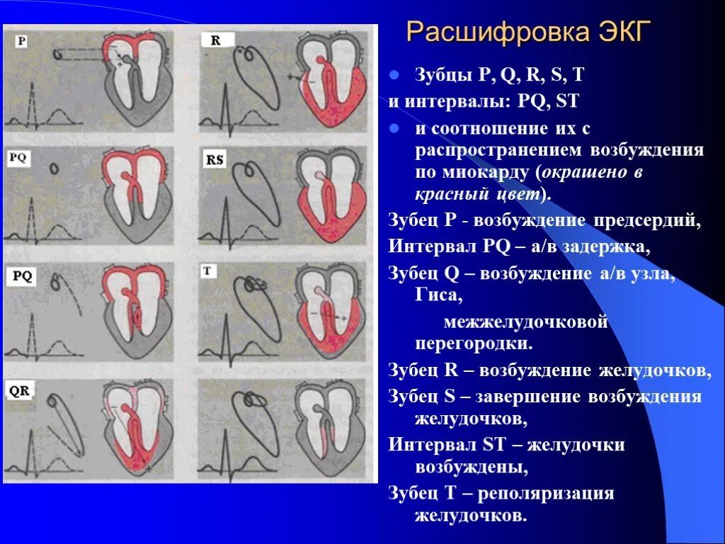 Расшифровка ЭКГ v1. ЭКГ сердца с расшифровкой зубцы. ЭКГ расшифровка зубцов в норме. Компьютерная интерпретация ЭКГ расшифровка.