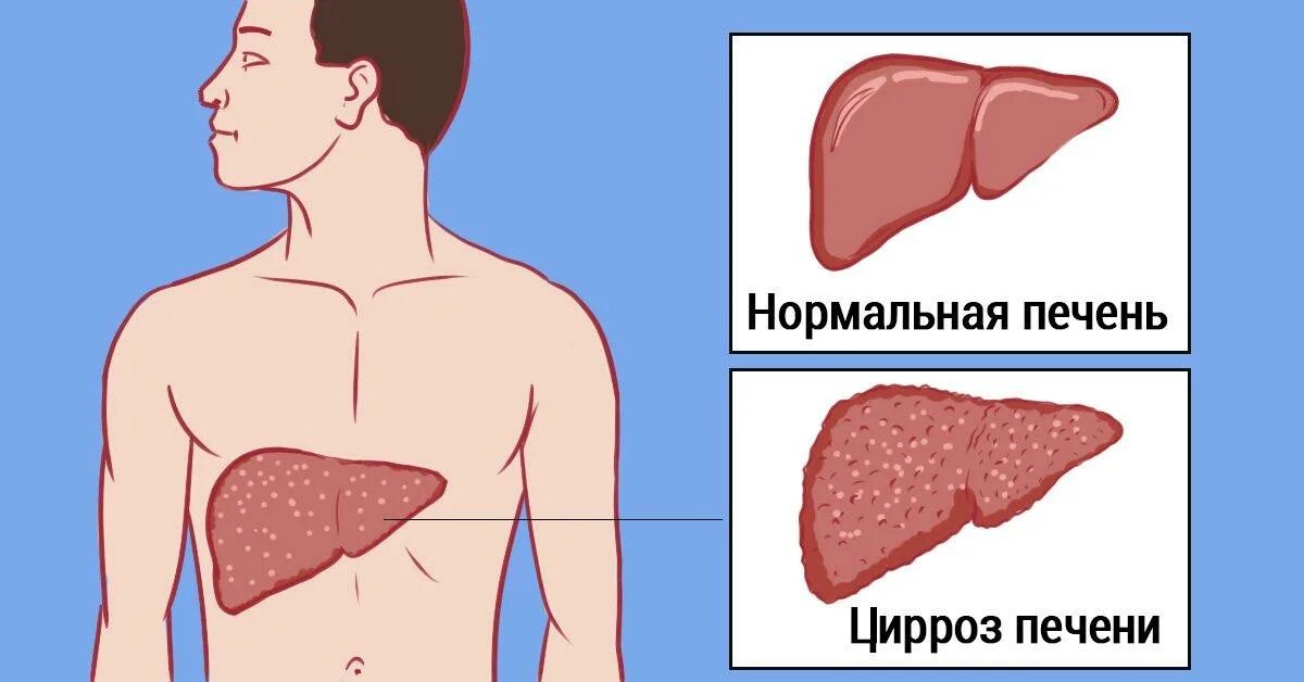 Какой здоровья печень