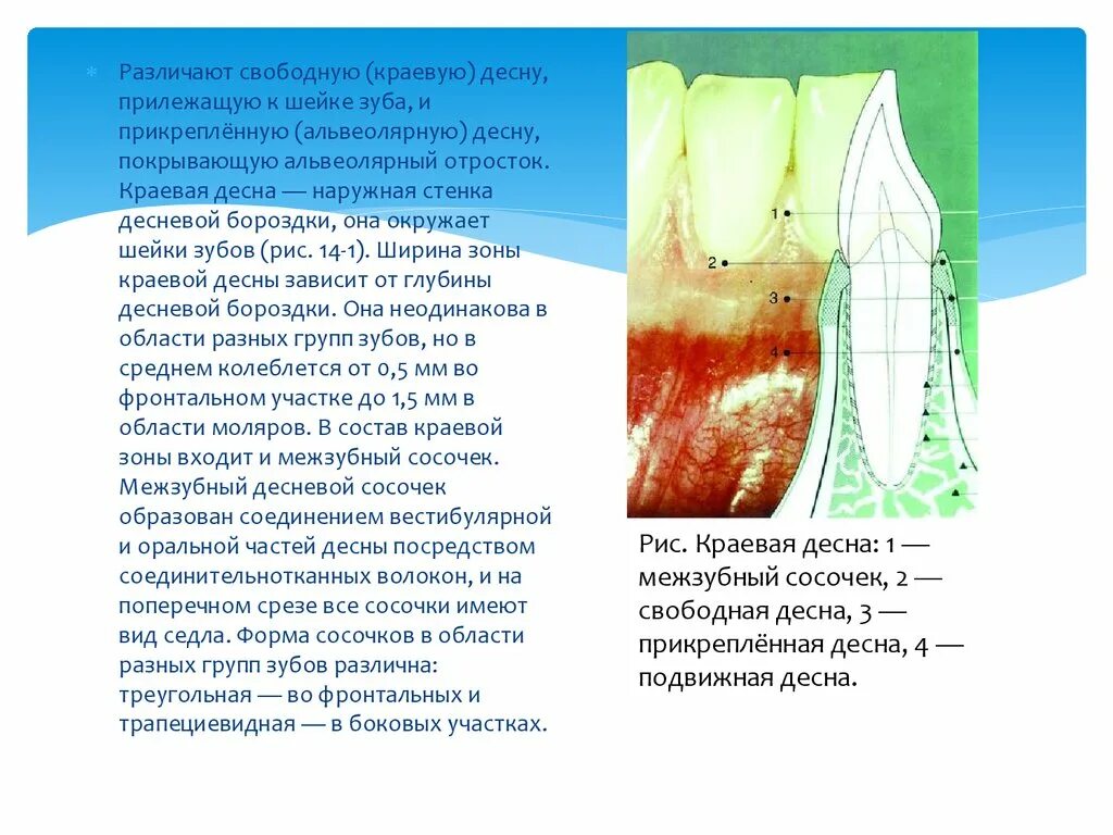 Глубина десневой бороздки. Десневой жидкости. Свободная и прикрепленная Десна. Состав десневой жидкости. Прикрепленная десна