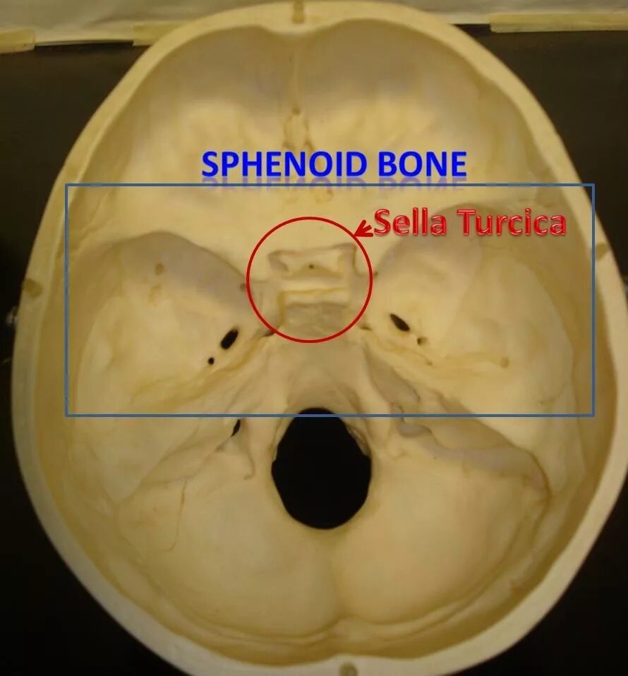 Турецкие седло кость. Турецкое седло, Sella Turcica. Sella Turcica анатомия. Кости черепа турецкое седло. Sella Turcica на черепе.