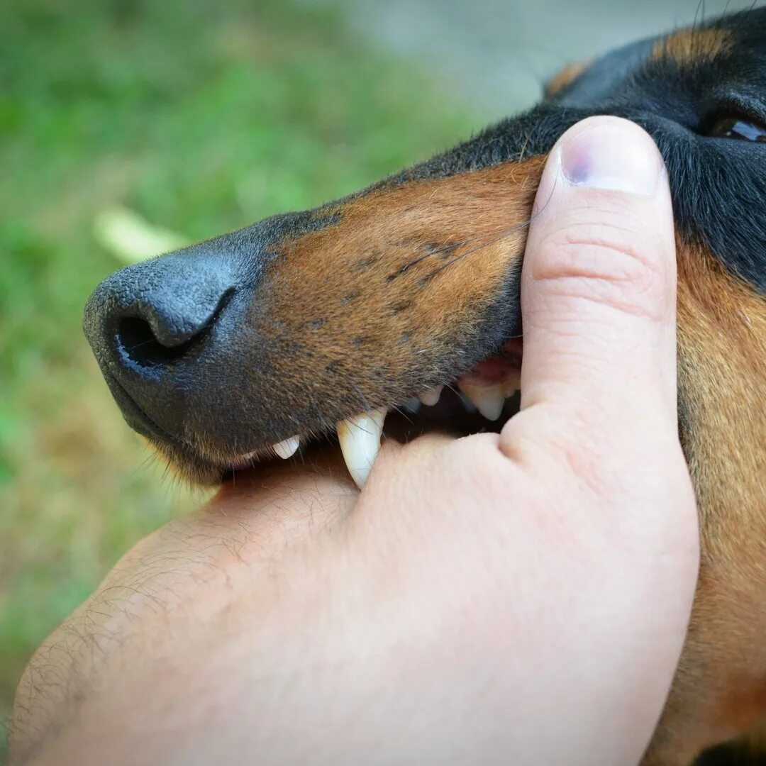 Animal bite. Animal bite