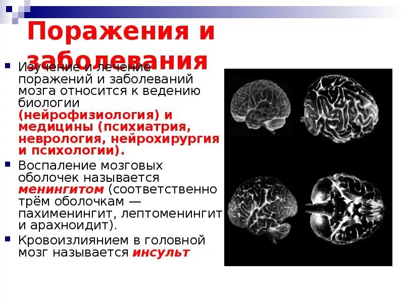 Органическое поражение мозга психиатрия. Органическое поражение мозга психиатрия. Органическое поражение мозга психиатрия. Органическое поражение мозга психиатрия. Характеристика психических расстройств при опухолях мозга.