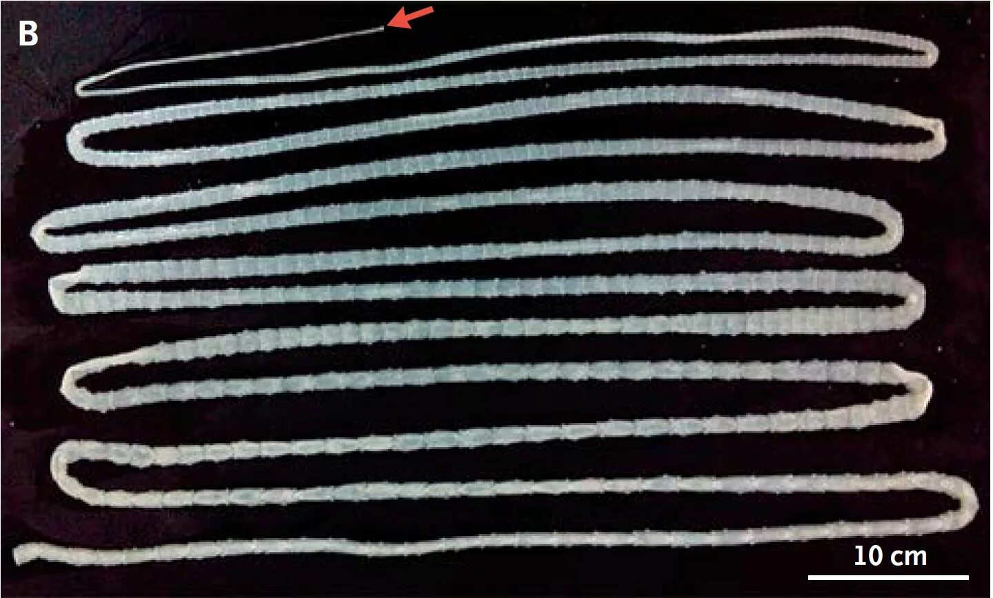 окончательный хозяин свиной цепень. 3 бычий цепень. 3 бычий цепень. бычий цепень среда обитания. возбудитель тениаринхоза.