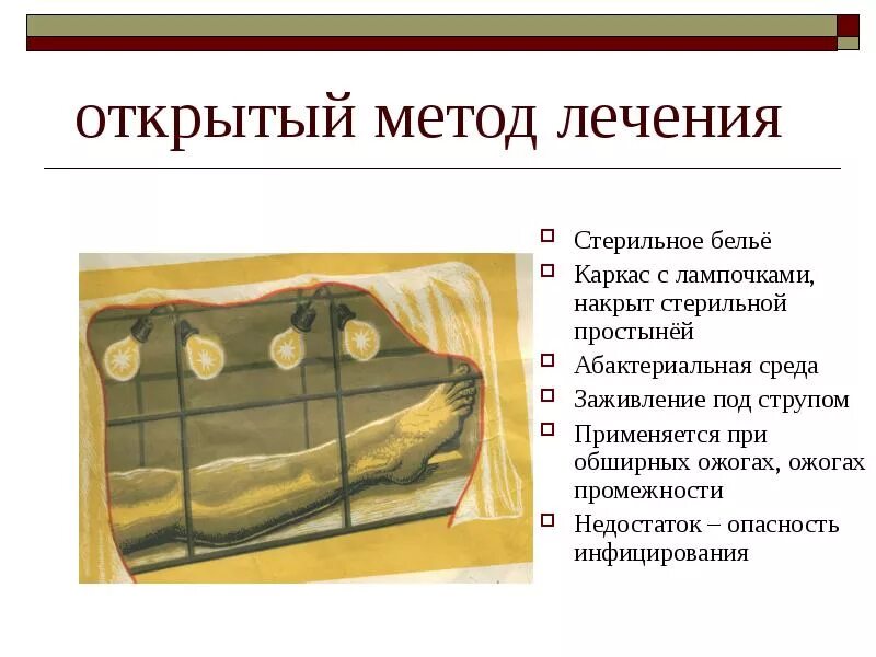 Методы лечения ожогов. Открытый метод лечения ожогов. открытый метод при ожогах. открытый способ лечения ожога. обработка ожоговой раны открытый способ.