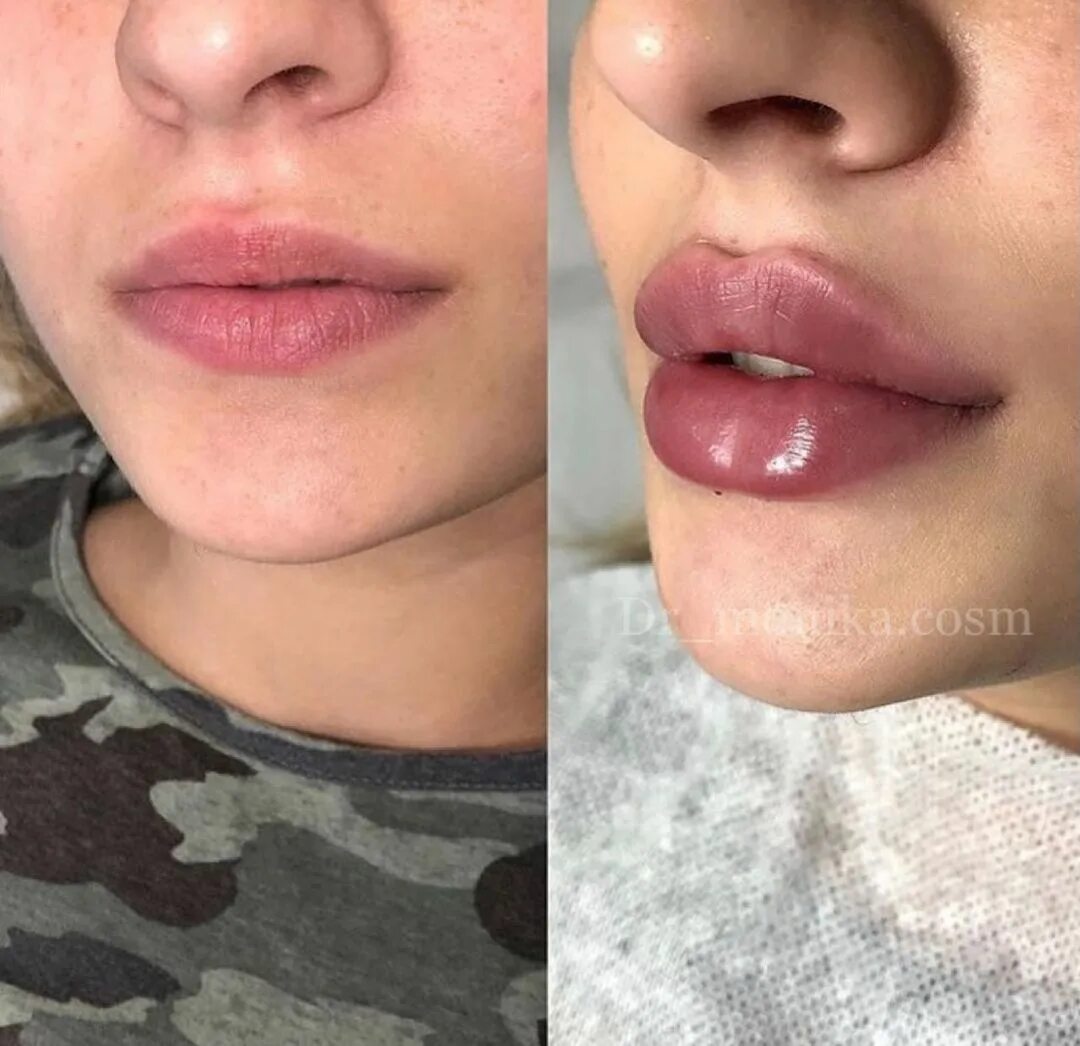 Форма губ бант. Техника увеличения губ бантиком. плоские увеличенные губы. плоские накаченные губы.