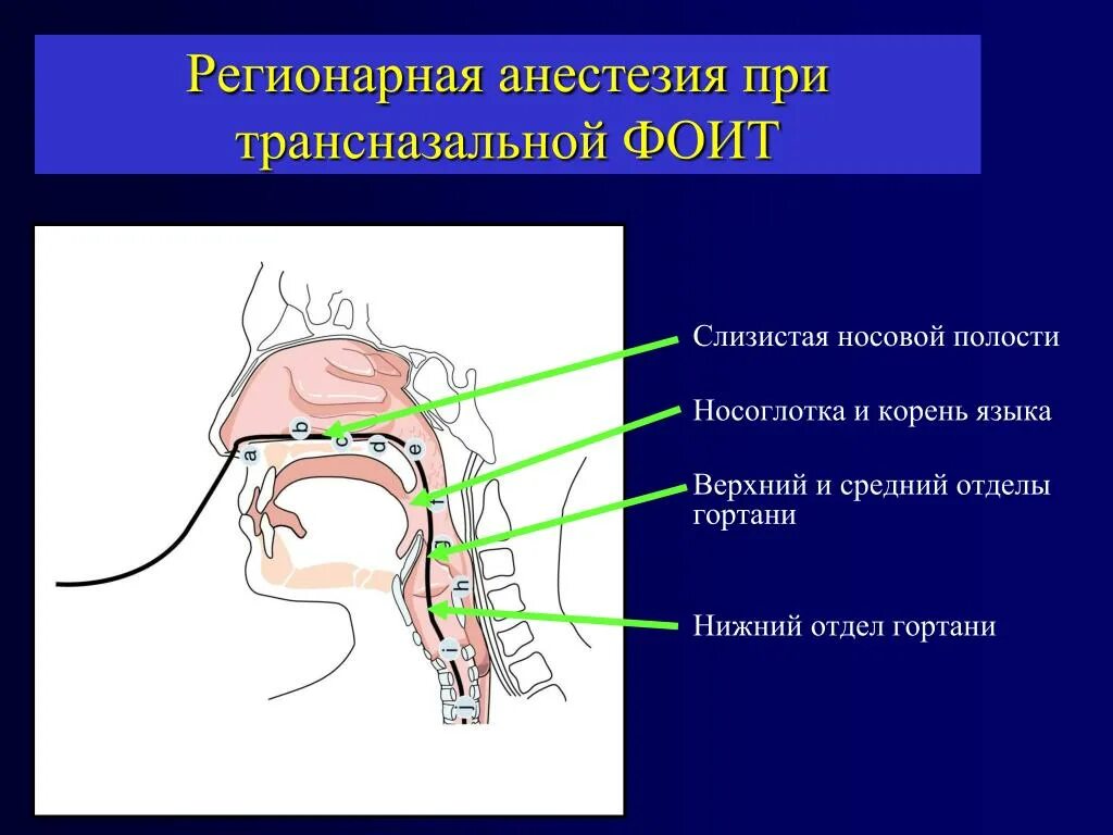 Болит горло наркоз. Регионарная анестезия. Обезболивание полости носа. Анестезия полости носа.