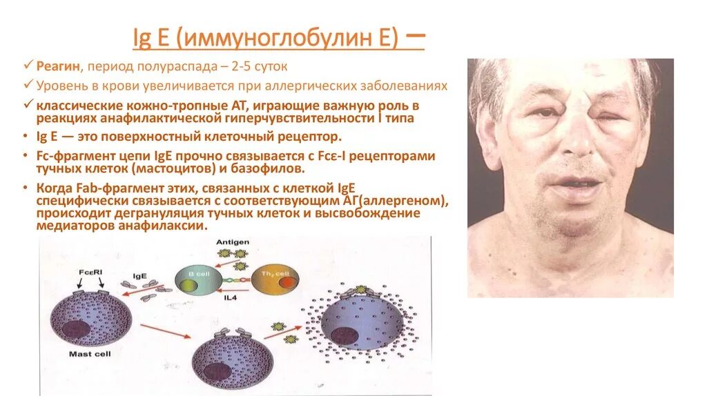 Иммуноглобулин превышен. Иммуноглобулин е 25,8. Иммуноглобулин е 7.8. Иммуноглобулин е 11,5. Иммуноглобулин е 32.4.