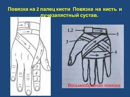 Первый палец кисти