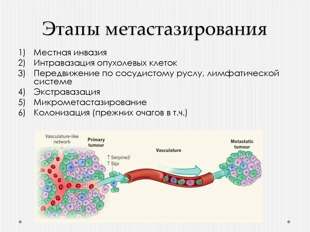 Стадия инвазивной опухоли процесс метастазирования. Механизм метастазирования схема. Схема метастазирования опухоли. Механизм гематогенного метастазирования. Без признаков инвазии