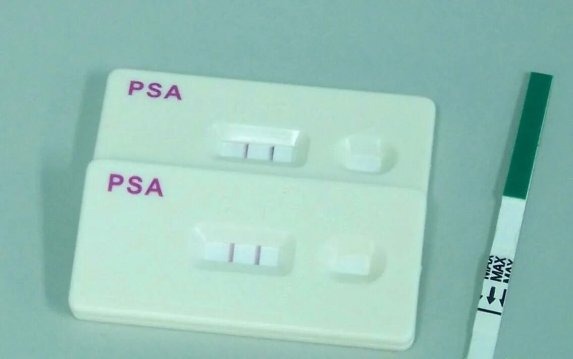Тест пса у мужчин. Простатоспецифический антиген свободный. Простатический специфический антиген пса. Тест пса свободный. Anifrolumab.