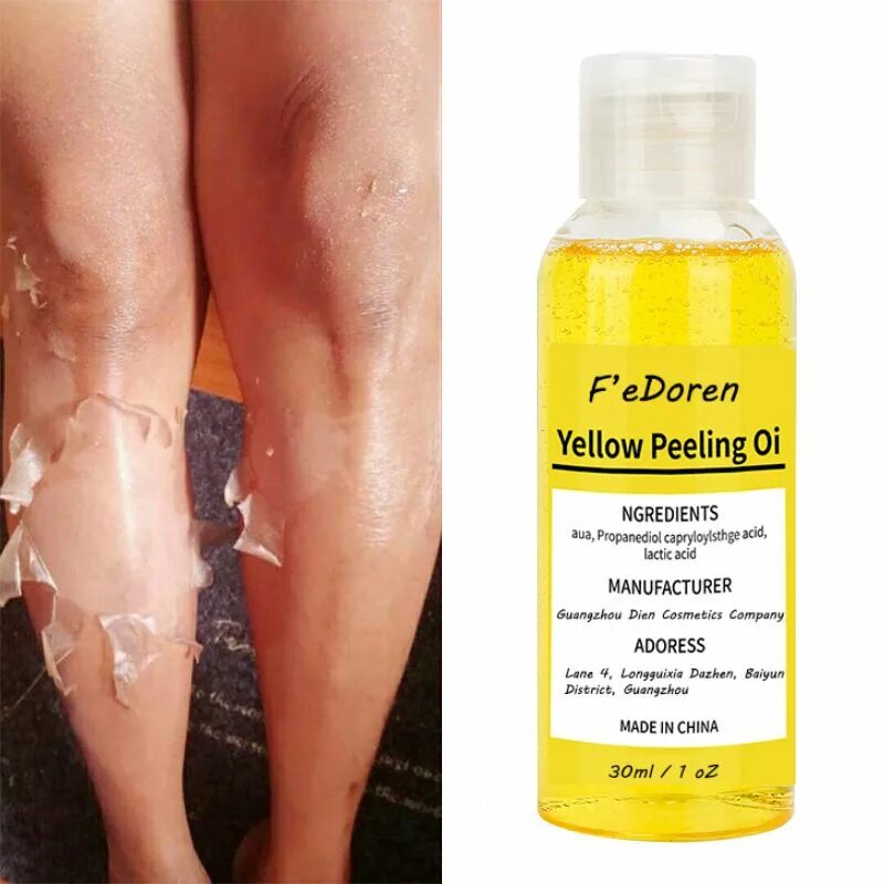 Пилинг для осветления кожи. Lightening пилинг. желтый пилинг lightening. жёлтый пилинг yellow peel set.