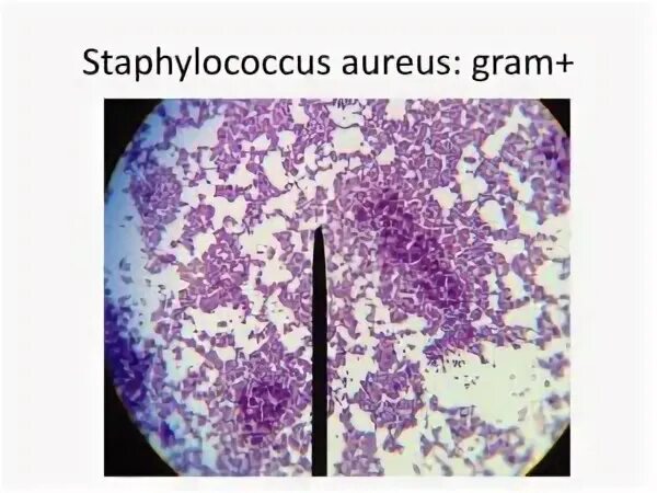 Staphylococcus aureus 10 4