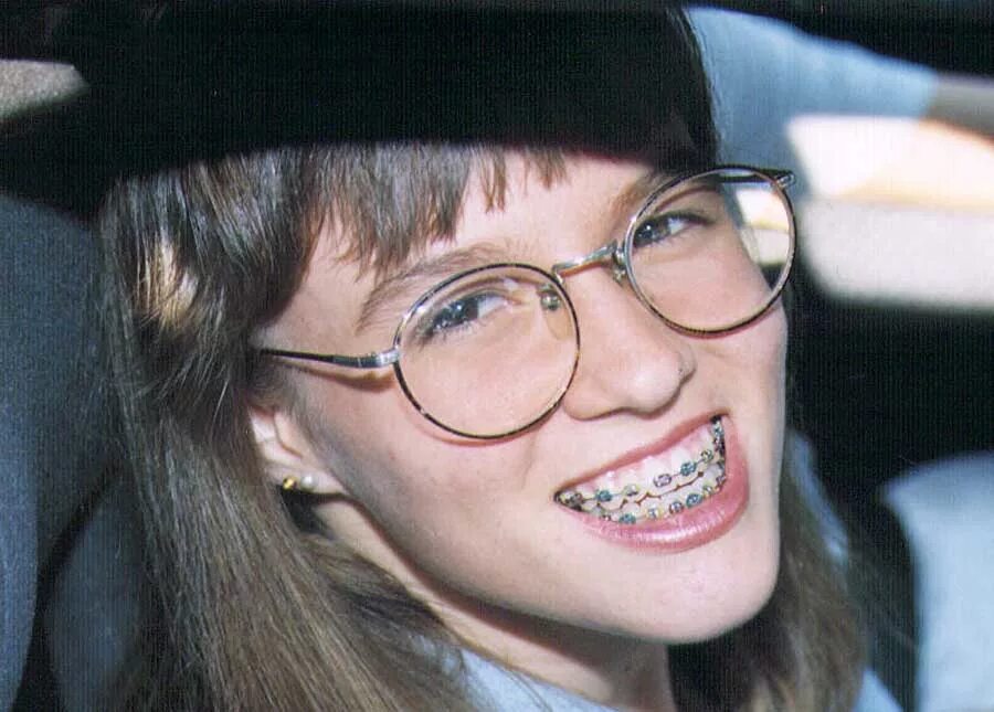 страшные брекеты. уродливая девочка с брекетами. девушки с брекетами и очками. металлические брекеты детям. маленькие девочки с брекетами.