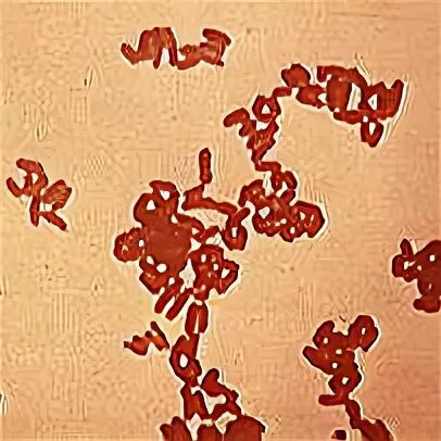 Atopobium в мазке у женщин. гарднерелла и мобилункус. бактериальный вагиноз мазок микроскопия. баквагиноз ключевые клетки. бактериальный вагиноз гарднереллёз.