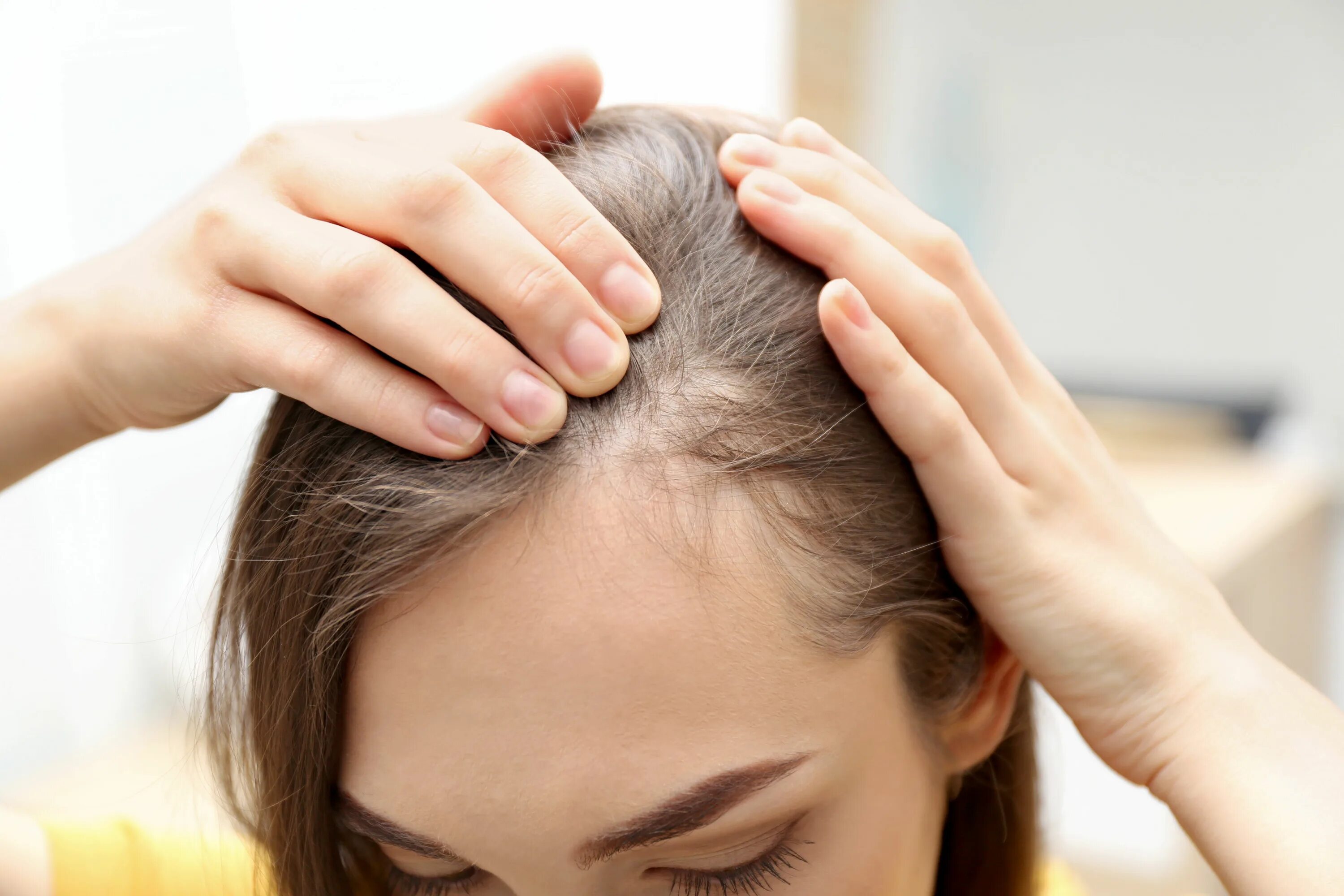 Истончение волос у женщин. Причина сильного выпадения