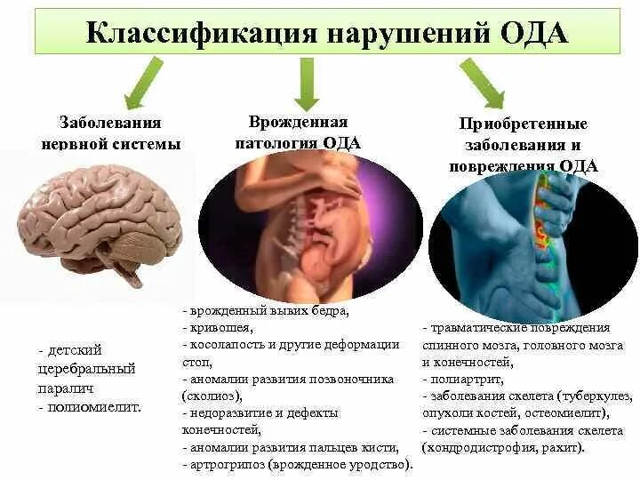 Наследственное заболевание мозга. Врожденные заболевания нервной системы. Патологии нервной системы у детей. Врожденные заболевания с поражением нервной системы. Врожденные заболевания центральной нервной системы.