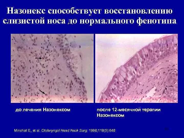 Регенерации слизистой оболочки