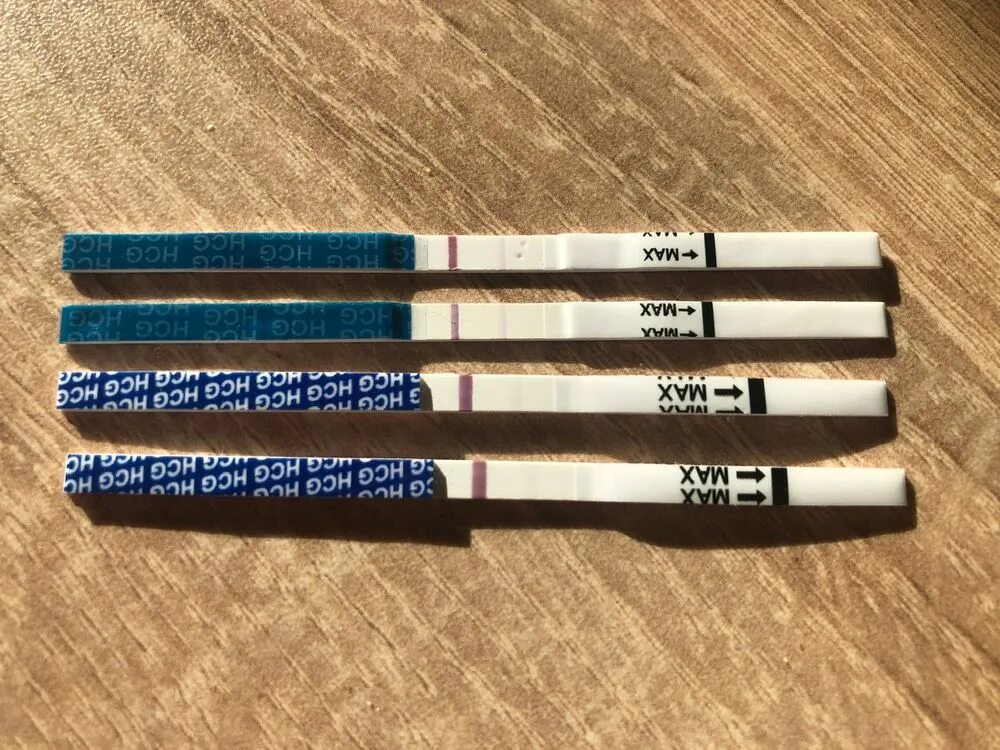 6 день после овуляции тянет низ. 6 дпо тянет низ живота. 6 день после овуляции тянет низ. 5 дпо тянет низ живота. 6 дпо тянет низ живота.