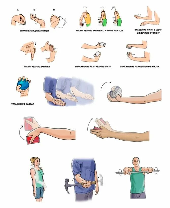 Комплекс лфк для лучезапястного сустава. ЛФК после перелома лучевой кости. Лечебная физкультура при переломе руки лучевая. Гимнастика кисти после перелома лучевой кости. Разработка кисти после перелома лучевой кости.