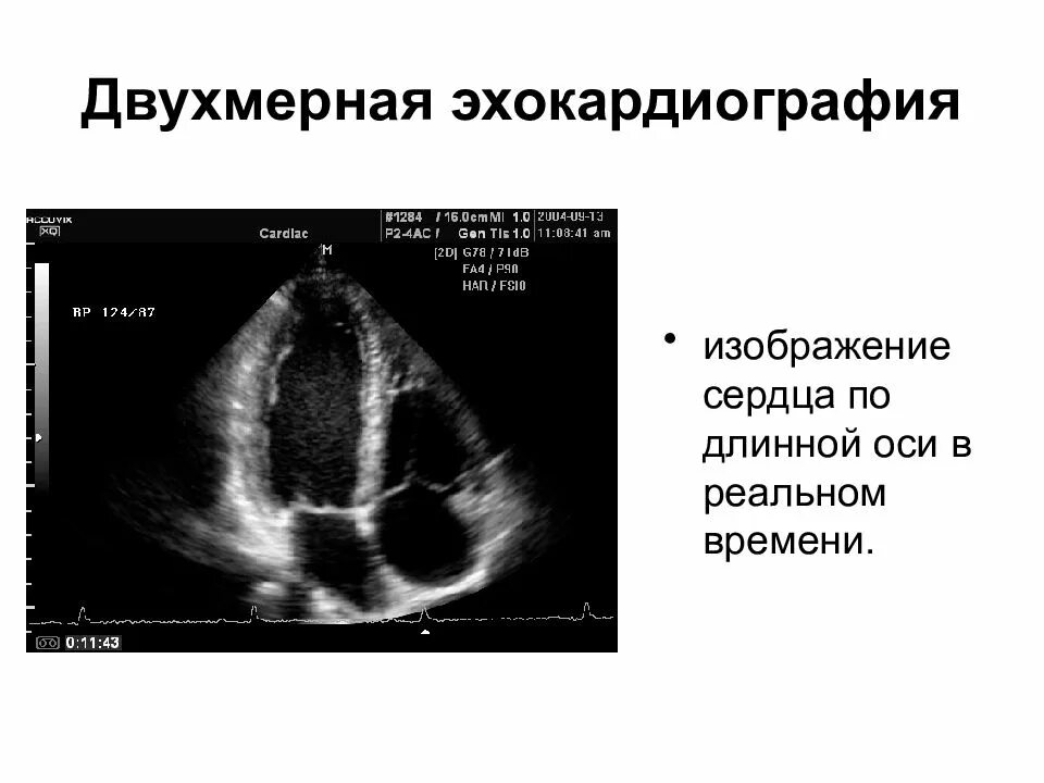 Эхо кардиография. Одномерная ЭХОКГ В М режиме. B режим ультразвукового исследования. Эхокардиография метод исследования. Эхокардиография (в комлексе в- и м-режимах).