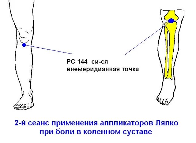 Болит колено в одной точке. Точки акупунктуры при боли в тазобедренном суставе. Болит колено в одной точке. Лин цюань. Болит колено в одной точке.