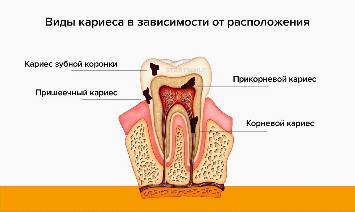 Признаки стороны зуба