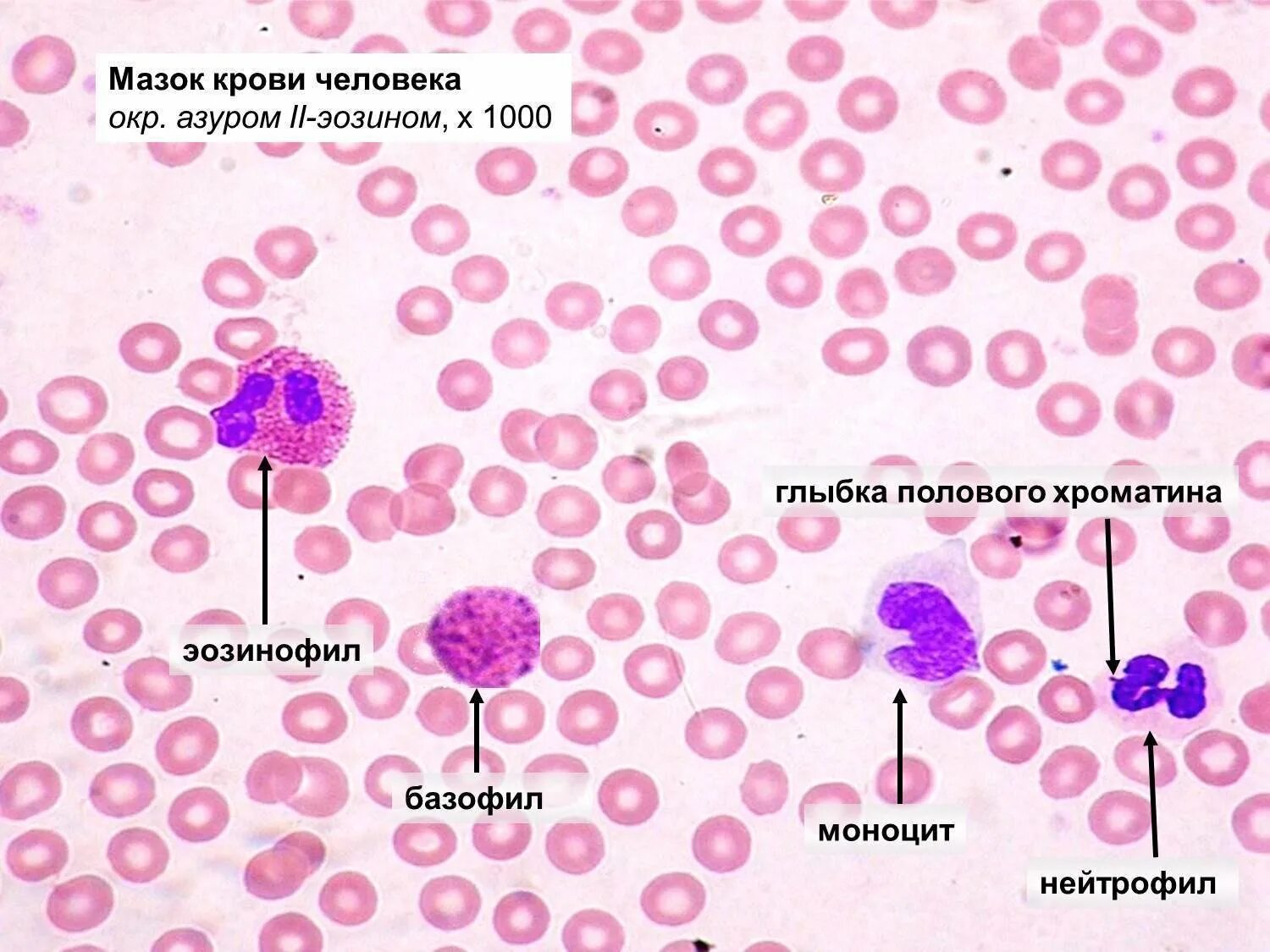 Мазок крови человека гистология препарат. Кровь человека гистология препарат. Мазок кровичелоаека гистология препарат. Мазок крови лейкоциты гистология. Эозинофилы моноциты тромбоциты