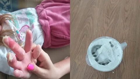 Девочка засунула палец