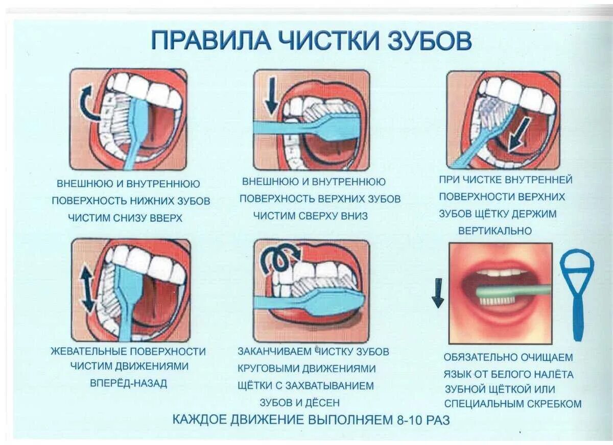 Почему после стоматолога нельзя есть 2 часа. Памятка как правильно чистить зубы. Правильная методика чистки зубов зубной щёткой. Алгоритм стандартного метода чистки зубов. Схема правильной чистки зубов для детей.