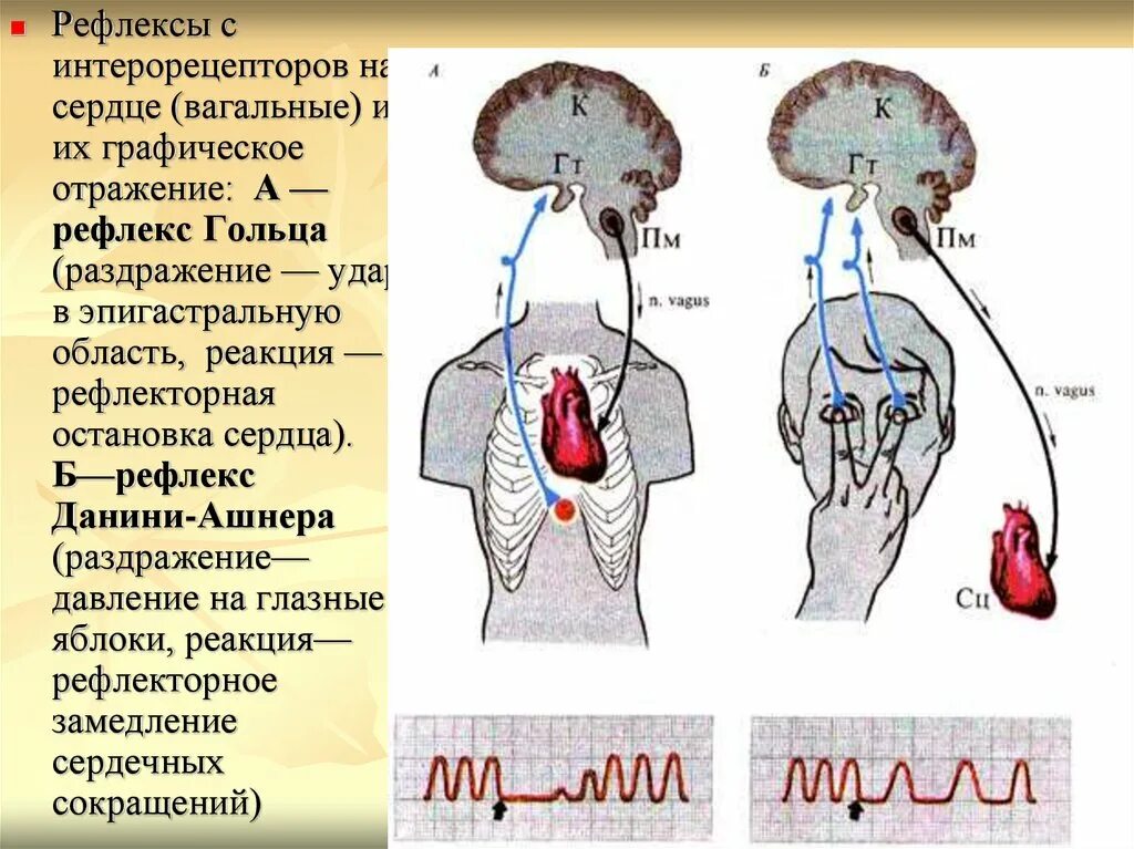 Рефлекторные пути рефлексов гольца и Данини-Ашнера. Рефлекс Данини Ашнера физиология. Рефлекторная регуляция деятельности сердца рефлекс Данини-Ашнера. Данини Ашнера рефлекс механизм.