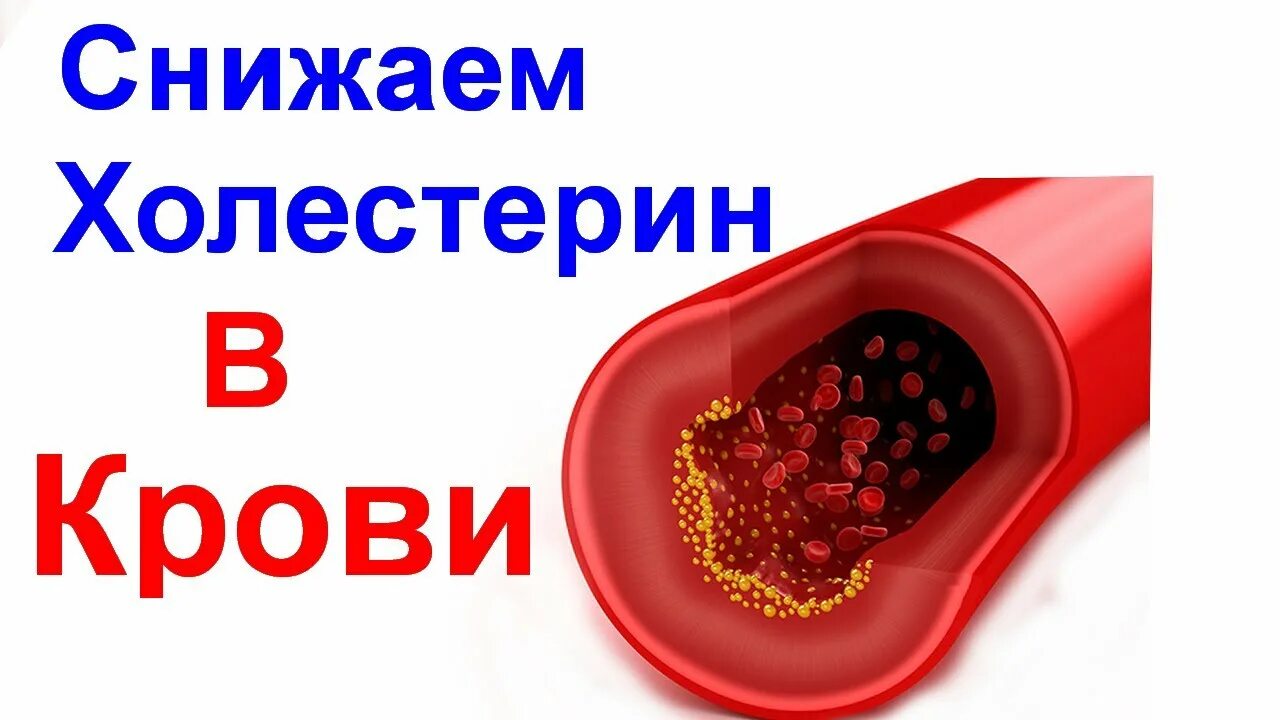 Как снизить холестерин в крови без лекарств. Что снижает холестерин. Снижение холестерина в крови. Как понизить холестерин в крови. Что понижает холестерин в крови.