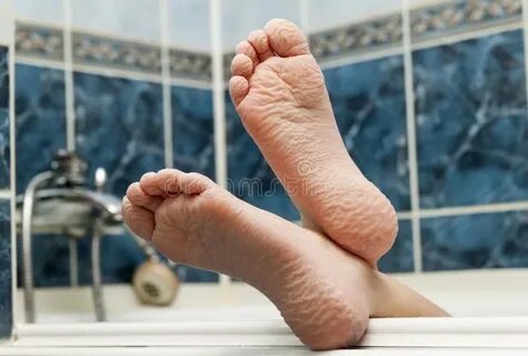 Wrinkled foot