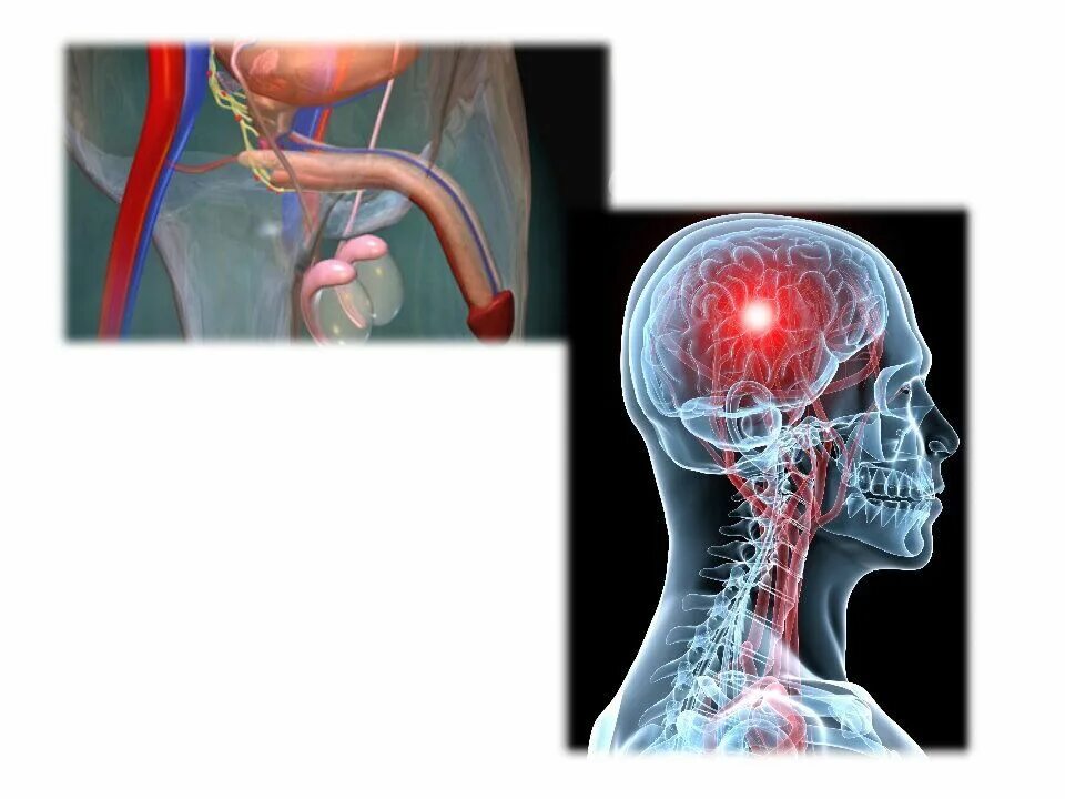 Почему у мужчины во время полового. Эректильная дисфункция. Электоральная дисфункция. Нейрогенная эректильная дисфункция. Сосудистая половая дисфункция.