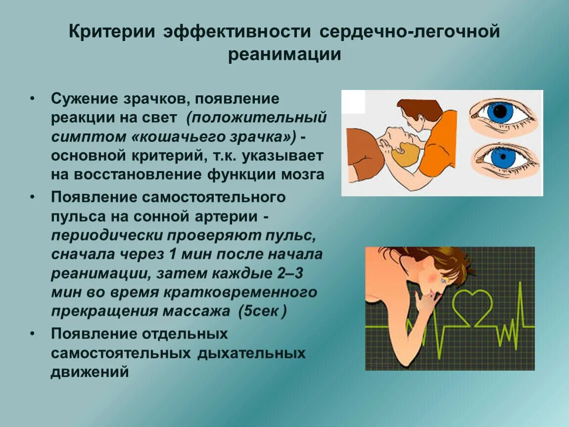 Критерии эффективности сердечно-легочной реанимации. Критерии эффективности сло. Критерии правильного проведения сердечно легочной реанимации. Критерии эффективности мероприятий СЛР. Отсутствие реакции зрачка на свет признак отсутствия