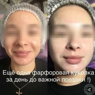 Фарфоровая кукла процедура до и после фото