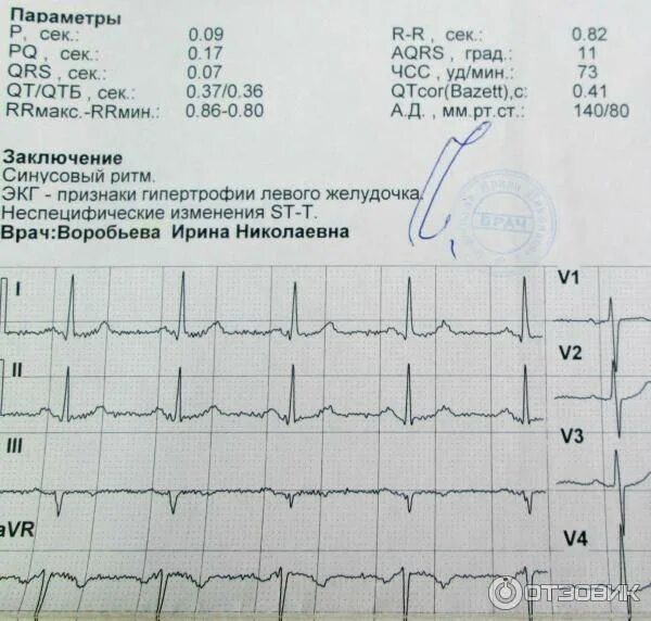 В кардиограмме написано