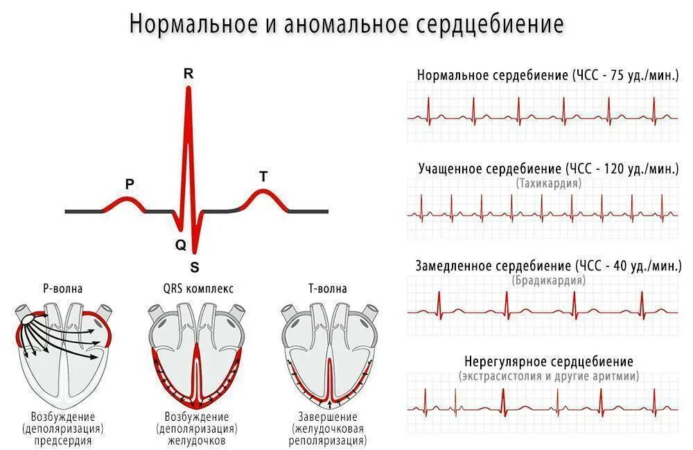 Сердечный ритм на ЭКГ норма. ЭКГ при тахикардии и брадикардии. Брадикардия на ЭКГ при аритмии. Синусовая брадикардия схема ЭКГ.