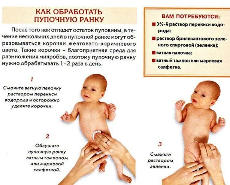 Обработка пупочной ранки при омфалите алгоритм. Техника обработки пупочной ранки алгоритм. омфалит обработка пупочной ранки алгоритм. обработка пуповины новорожденного алгоритм. алгоритм при обработке пупочной ранки.