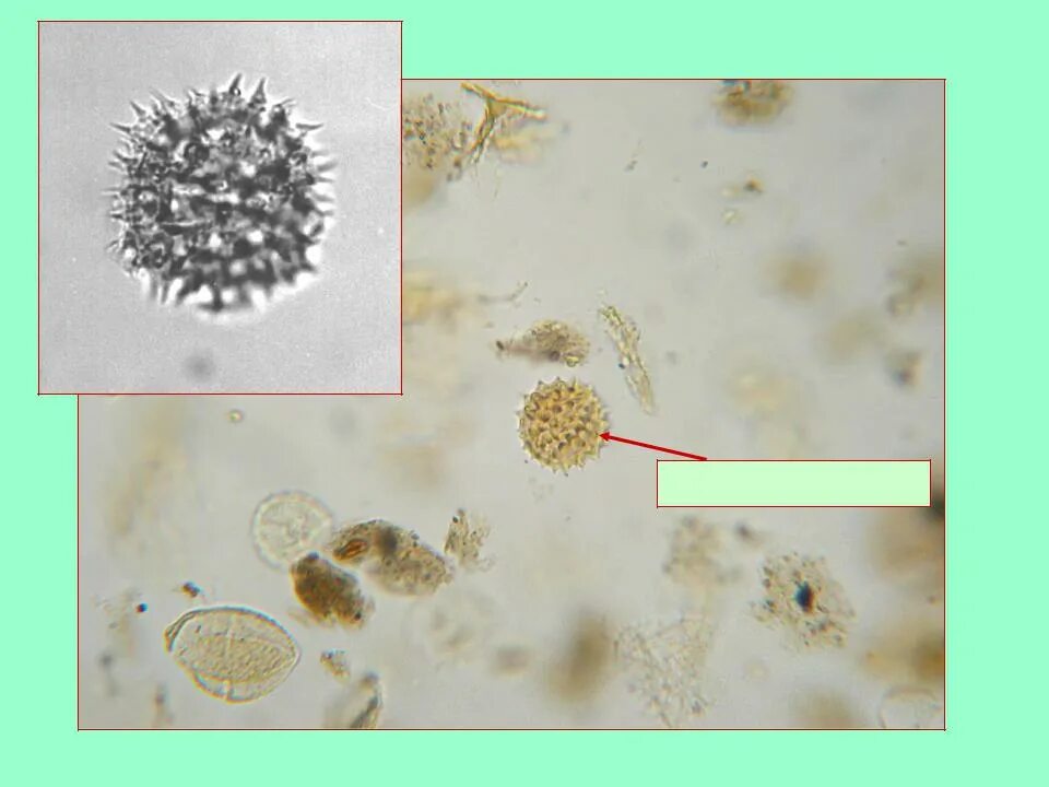 Спорово-пыльцевой метод. Споро-пыльцевой. Пыльца микроскопия атлас. Пыльца микроскопия палинология. Пыльца и споры