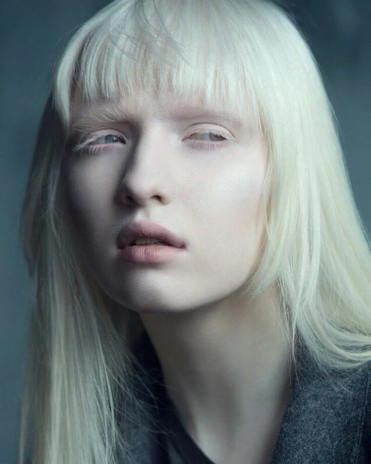 Страдающий альбинизмом. Настя Кумарова. Модель-альбинос Настя Кумарова. Настя Кумарова модель.