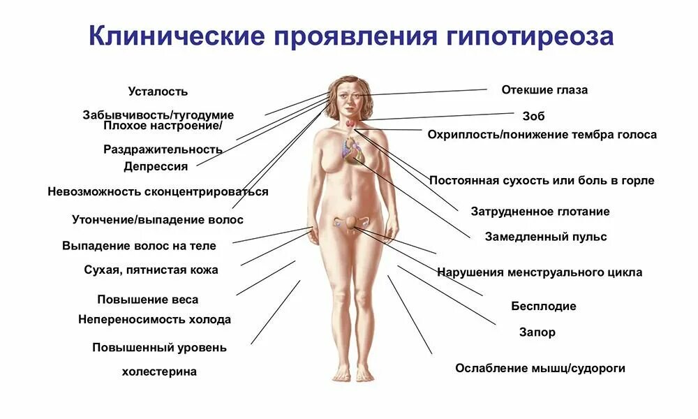 Депрессия какой гормон. Синдром гипофункции щитовидной железы. Сниженная функция щитовидной железы. Снижение функции гормоны щитовидной железы. Клинические симптомы гипотиреоза.