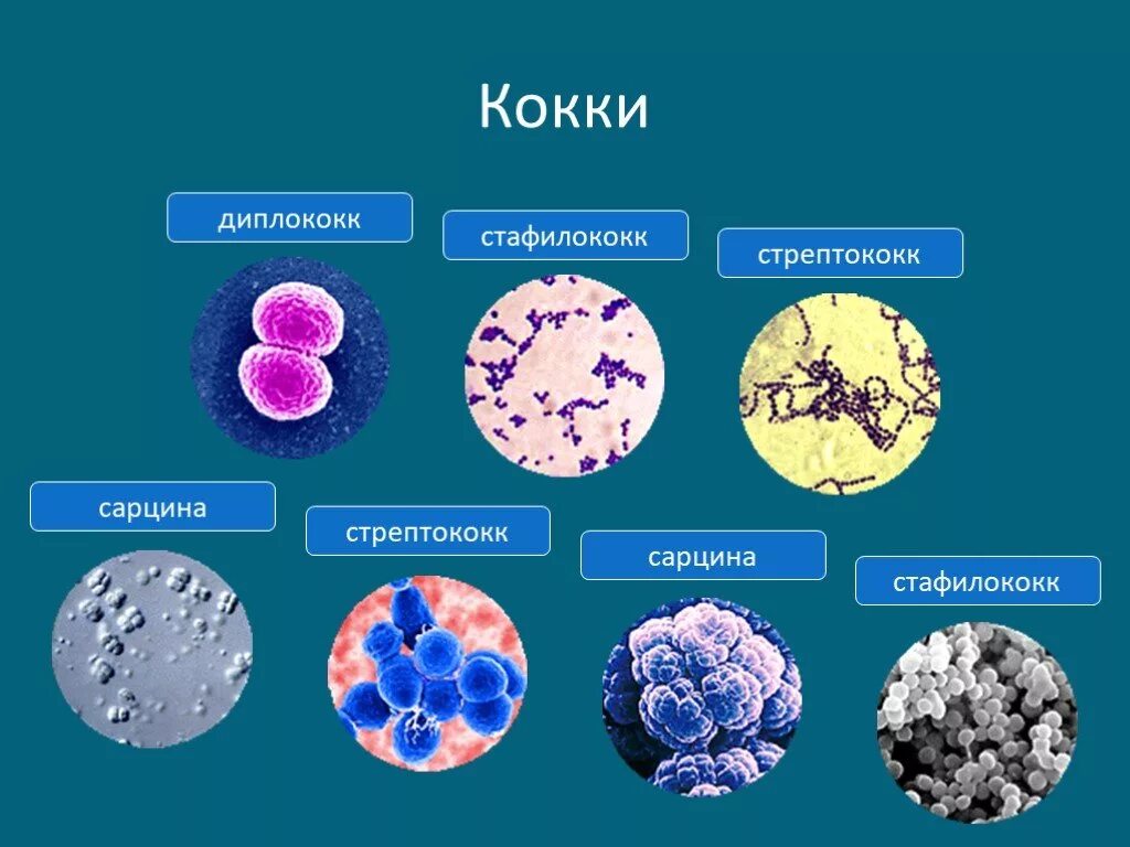 Стрептококки представители. Шаровидные бактерии кокки рисунок. Бактерии кокки стрептококки. Кокки стрептококки бациллы. Кокки (бактерии) стафилококки.